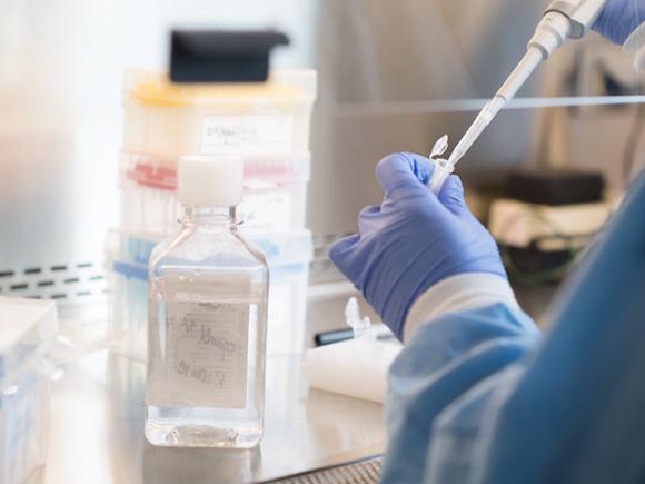 A gloved hand taking samples into a pipette for examination